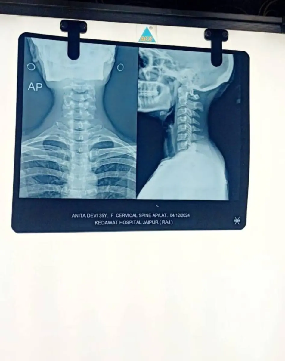 Physio Plus Hub - Treatment facility and rehabilitation equipment in Tripolia Bazar, Jaipur - Photo 4