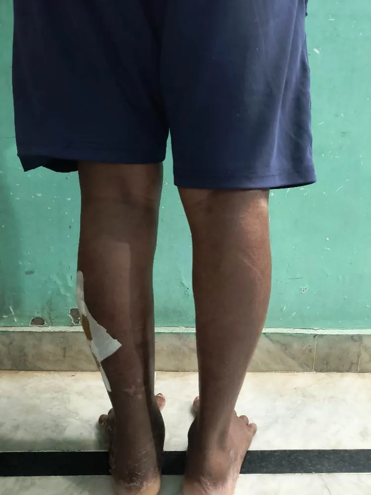 Physio Vani@home Care - Treatment facility and rehabilitation equipment in Simhachalam, Visakhapatanam - Photo 4